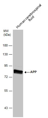 Anti-APP antibody (GTX112677) | GeneTex